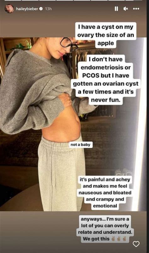 Hailey Bieber reveals she has ovarian cyst: What to know about the ...