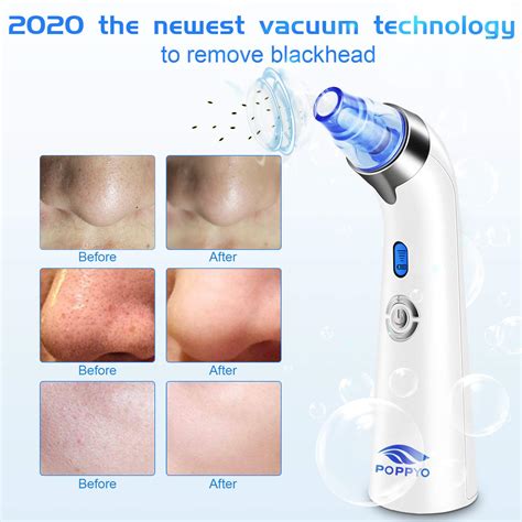 Best Blackhead Remover On 2020: A Complete Buyer’s Guide