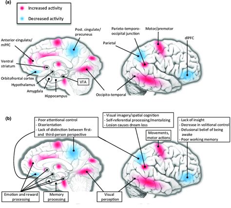 (a) Functional neuroanatomy of REM sleep. Brain regions more activated ...