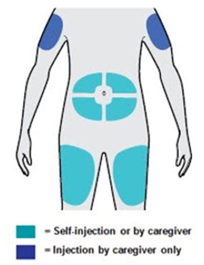 NDC 0024-5919 Dupixent Injection, Solution Subcutaneous Label ...