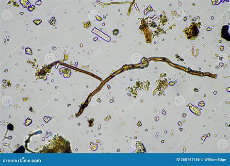 Soil Sample Under the Microscope. Soil Fungi and Microorganisms Cycling ...