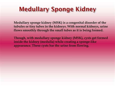 Medullary Sponge Kidney