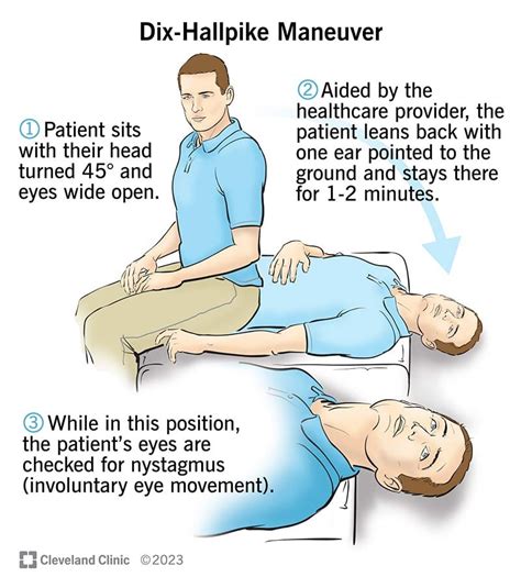 Epley Procedure At Home