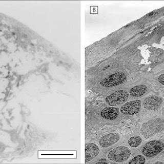 A, Photomicrograph of the operculum. A cellular fragment composed of ...