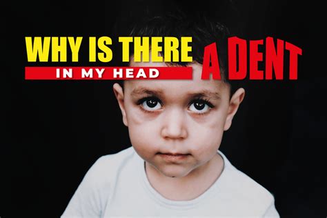 Why Is There A Dent In My Head - Exploring The Causes And Treatments