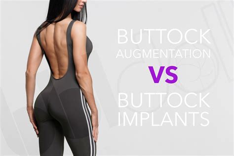 BBL-Doll's Weblog - Buttock Augmentation – Fat Transfer vs. Buttock ...