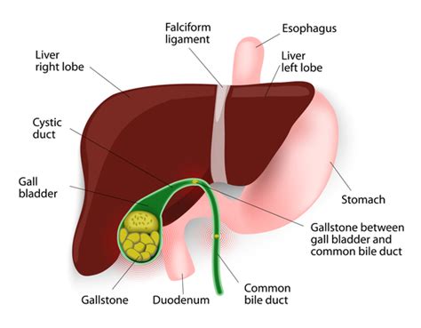 Gallbladder Pain Location Diagram