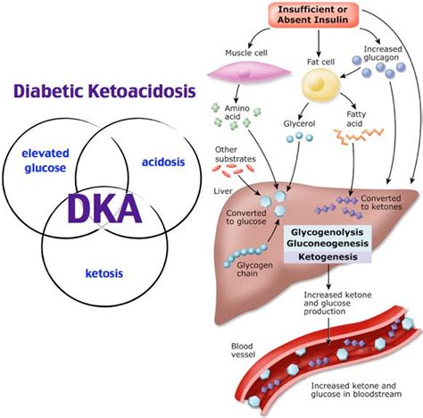 Hypophosphatemia Impairs ATP production Causes: DKA, malabsorption ...