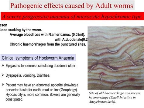 Hookworm infection