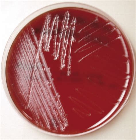 Clostridium Tetani Colony Morphology