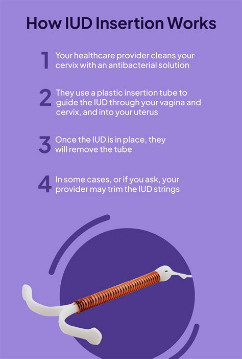 IUD Insertion: How it Works and What to Expect