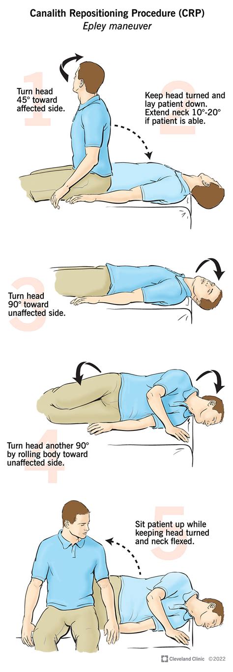 Epley Maneuver To Treat Bppv Dizziness Epley Maneuver Physical | Images ...