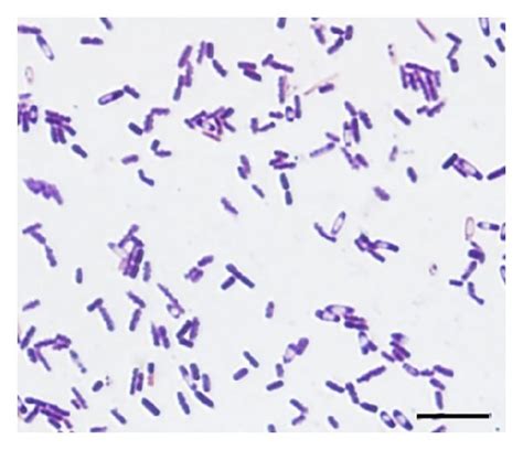 Clostridium Difficile Gram Stain