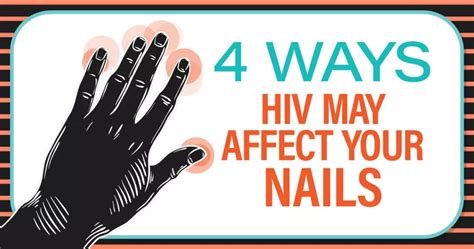 4 Ways HIV May Affect Your Nails | myHIVteam