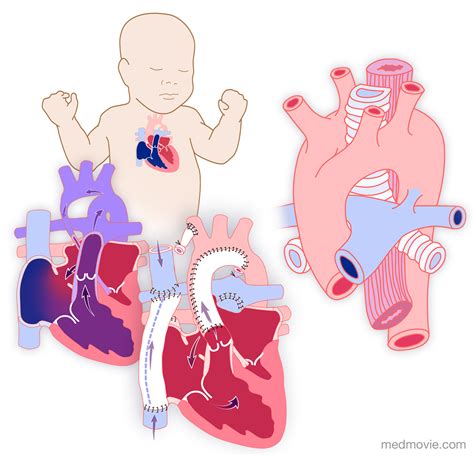 Pediatric Cardiology Media Library-VIDEO