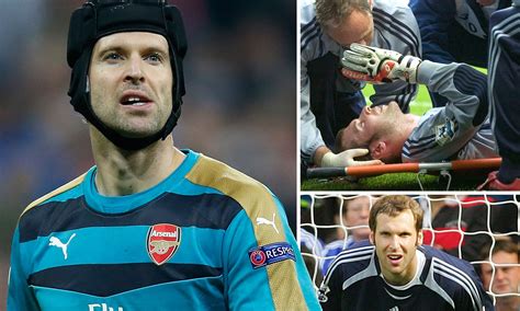 But Why Does Petr Čech Always Wear A Helmet? But Why Does, 48% OFF