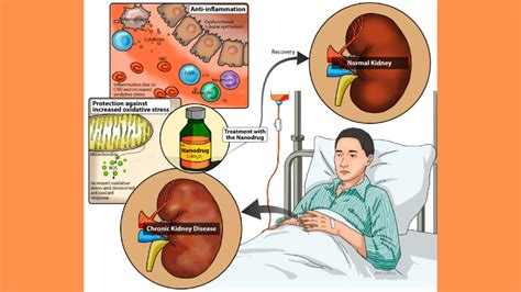 Redox medicine for the treatment of chronic kidney disease ...