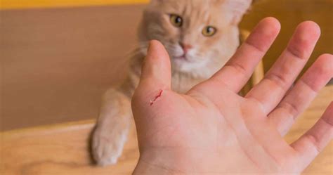 Cat scratch disease, cat scratch fever causes, symptoms, diagnosis ...