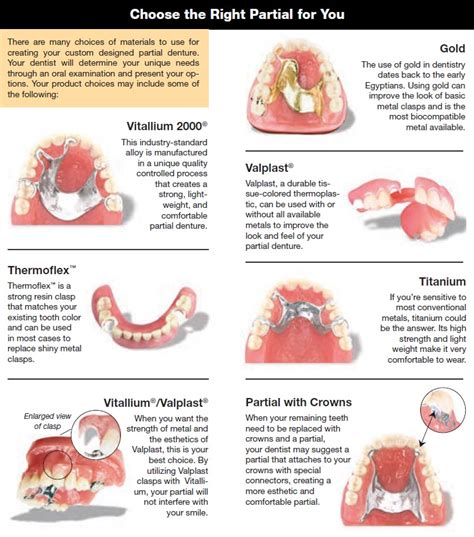 Partial Dentures - Cosmetic Dentistry in Oxnard CA | Dr Yianni Magnis DDS