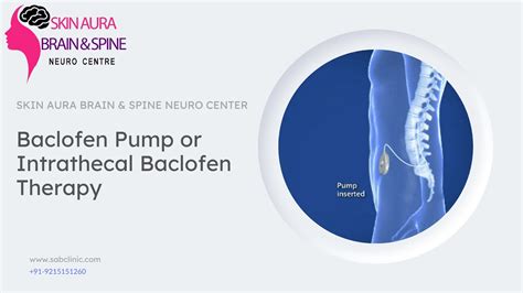 Baclofen Pump | Intrathecal Baclofen Therapy | Dr. Vika Kathuria - YouTube