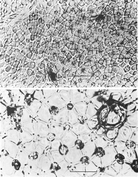 Surface view of the almost mature hymenium of a sporeless mutant of C ...