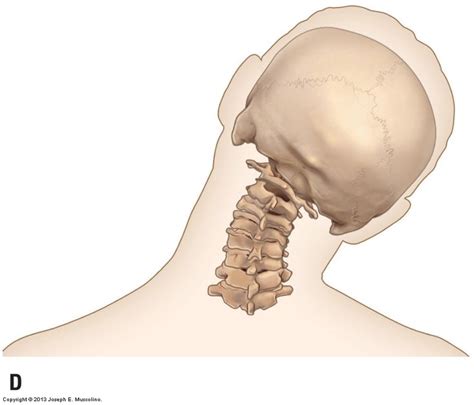 Pin on Neck Pain