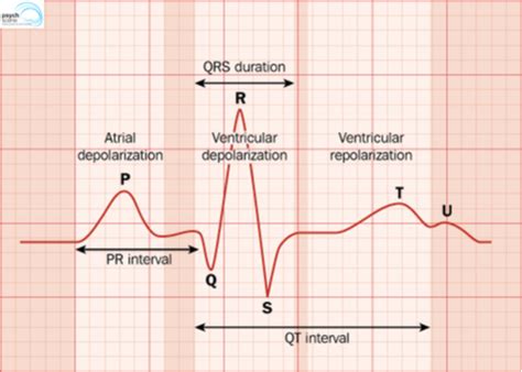 QTc Prolongation and Psychotropics- Clinical Evaluation and Management