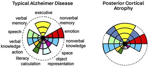 Posterior cortical atrophy causes, symptoms, diagnosis, treatment ...