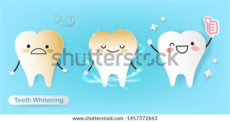 Cute Cartoon Teeth Before After Cleaning Stock Illustration 1457372663 ...