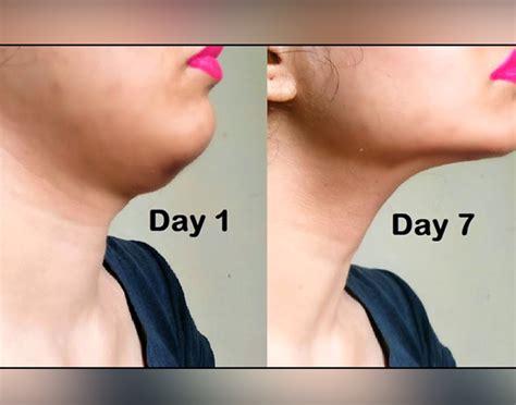 Get Rid of Double Chin with Proven Exercises and Diet Tips | FITPASS