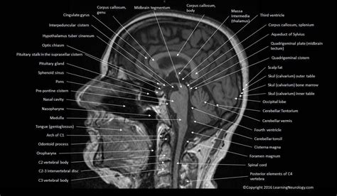 Mri Anatomy Of Brain - ANATOMY