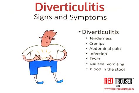 Diverticulitis Symptoms