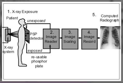 Computed Radiography: Advantages, Equipment and More - Engiomed