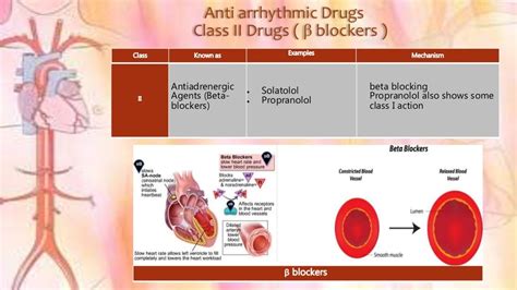 Cardiac arrhythmia and its treatment