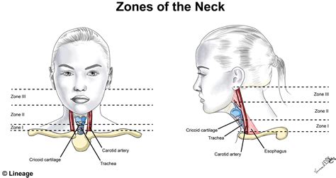 Neck Trauma - Ear, Nose, Throat - Medbullets Step 2/3