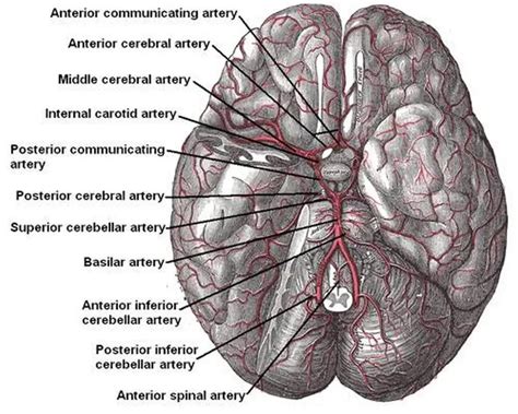 Pictures Of Anterior Communicating Artery