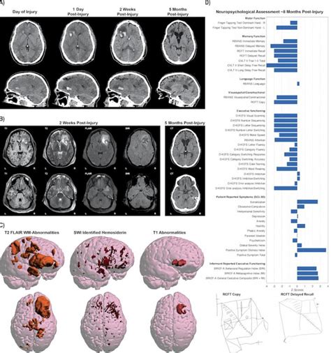 Global MRI data offers hope for improving tre | EurekAlert!