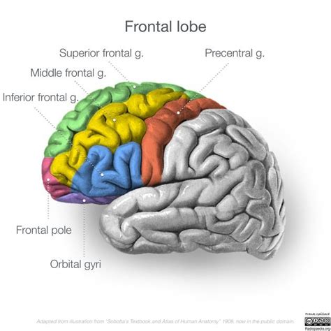 Temporal lobe | Radiology Reference Article | Radiopaedia.org | Lobes ...