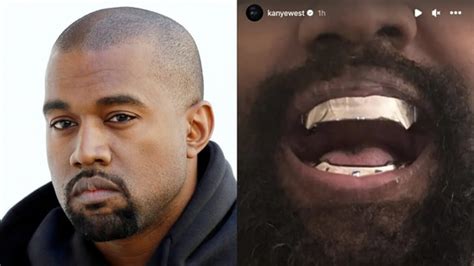 Kanye West reportedly replaced his teeth with $850k James Bond-inspired ...