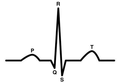 Normal Ecg Tracing