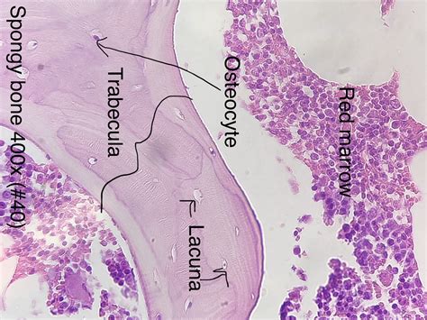 Spongy Bone Connective Tissue