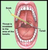 Throat Culture Procedure - RNpedia