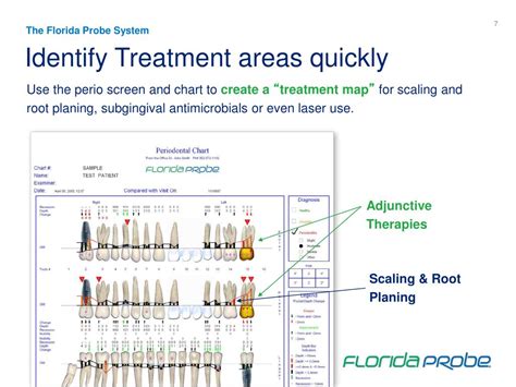 PPT - What is the Florida Probe System? PowerPoint Presentation, free ...