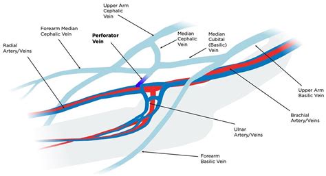 Novel classification of proximal forearm perforator vein in the ...