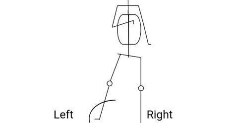 Hemiplegic Gait I circumduction gait Physiotherapy Mx - PHYSIO STUDY