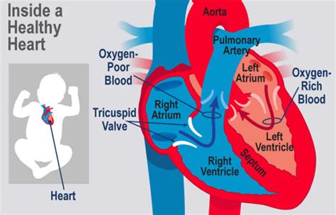 Tricuspid atresia causes, symptoms, diagnosis, treatment & prognosis