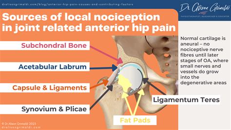 Anterior Hip Pain: Causes and contributing factors | Find out more