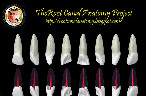 The Root Canal Anatomy Project: Maxillary Central Incisor