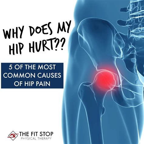 Diagnose Hip Pain Diagram