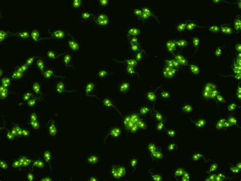 Scimedx IFA Autoimmune Assays — Scimedx Corporation